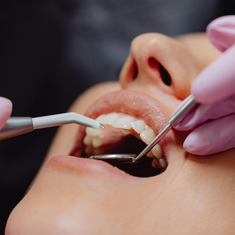 Dental Checkup