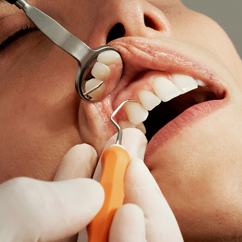 Hygienist Clean